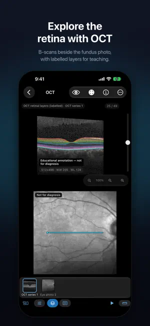 Voxelis: DICOM Viewer CT & MRI screenshot 3