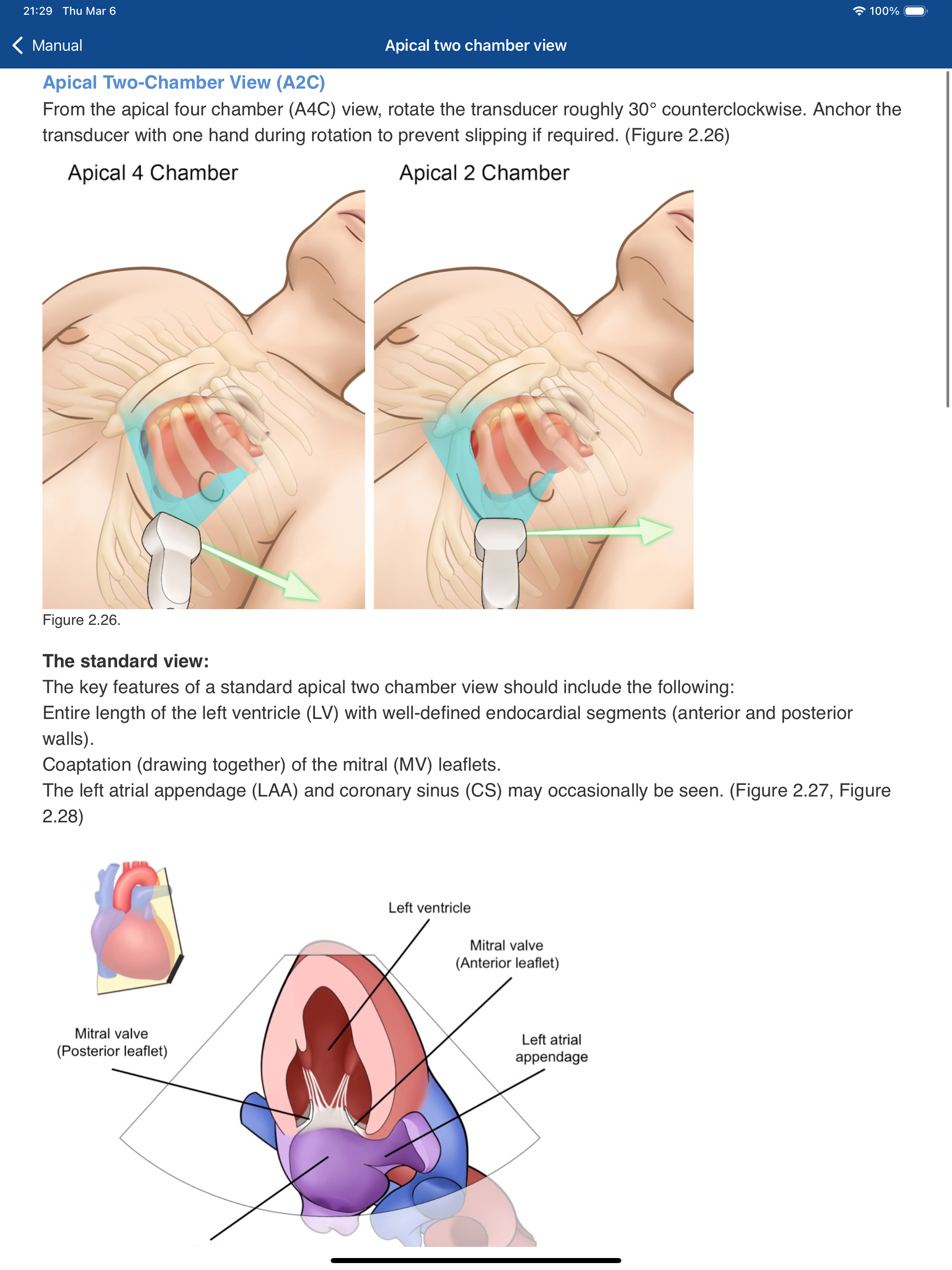 BASIC - Transthoracic Echocard screenshot 6