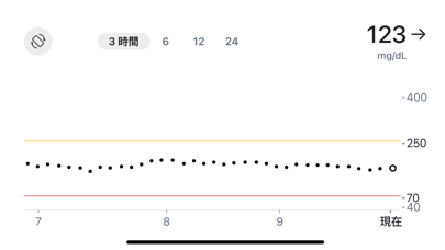 Dexcom Follow のスクリーンショット