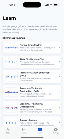 ECG Insight — Watch ECG Screenshot 5 of 5