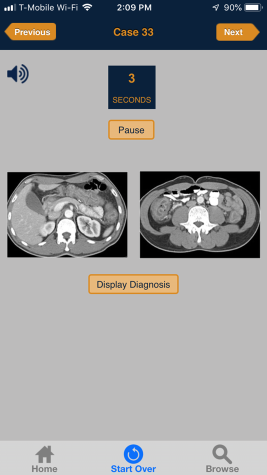 #2. CTisus 10 Minute ER Challenge (iOS) Podle: Elliot Fishman