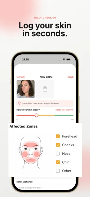 Claro: Acne Tracker screenshot 2