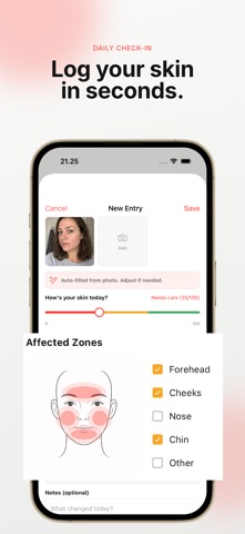 Claro: Acne Tracker iPhone screenshot