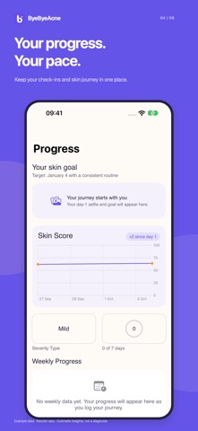 ByeByeAcne: AI Acne Scanner Screenshot 4 of 6