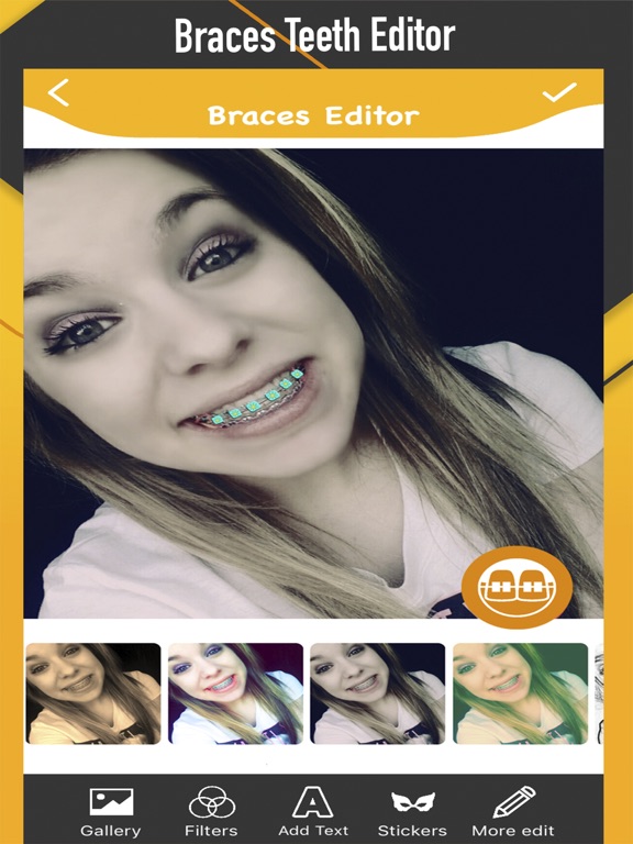 Screenshot #4 pour Braces Photo Editor - Sticker