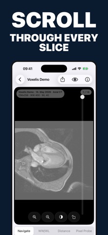 Voxelis: DICOM Viewer Screenshot 5 of 10
