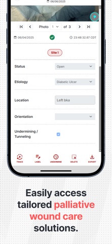 WoundSnap.ai Screenshot 5 of 10
