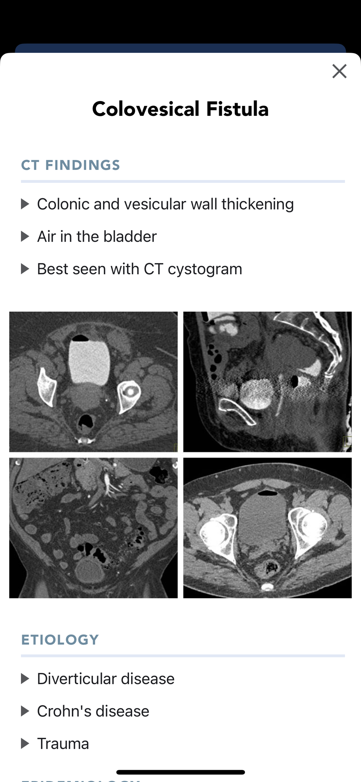 CTisus CT Quick Guides screenshot 3