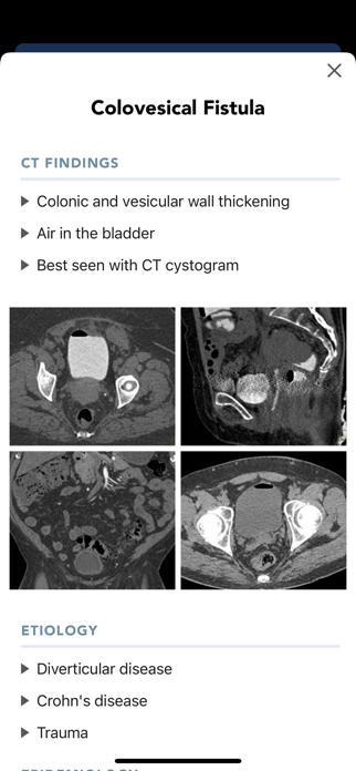 CTisus CT Quick Guides Screenshot 3 of 5