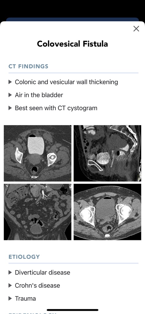 CTisus CT Quick Guides - Medical App | MWM