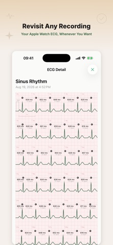 CardioWatch Pro Screenshot 7 of 7