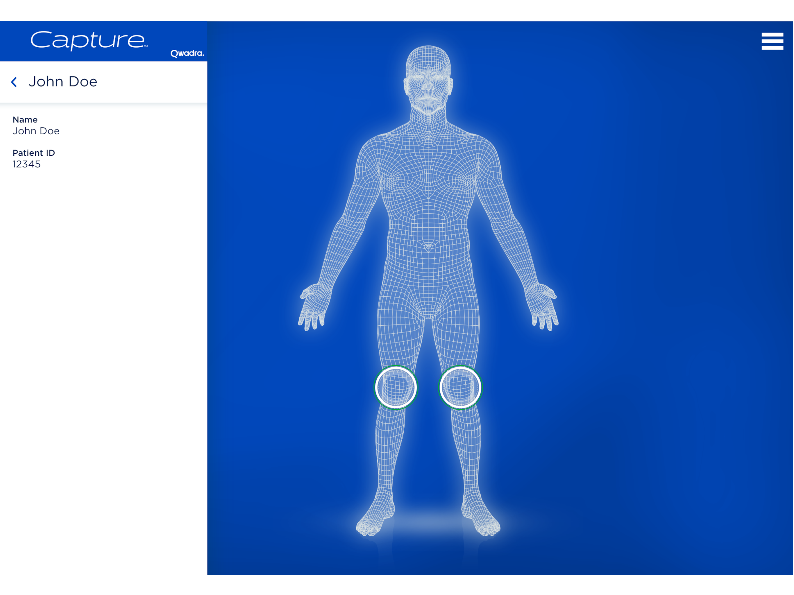BregScan 3D