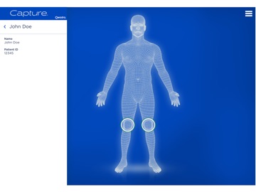 BregScan 3D iPad screenshot