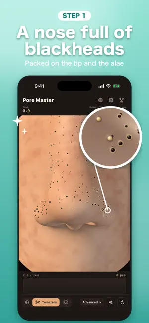 Pore Master: Blackhead Popper screenshot 1