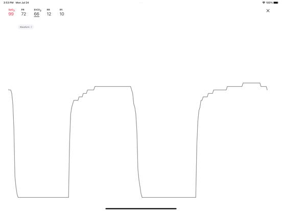 Vital Sync iPad screenshot 4 - Medical app
