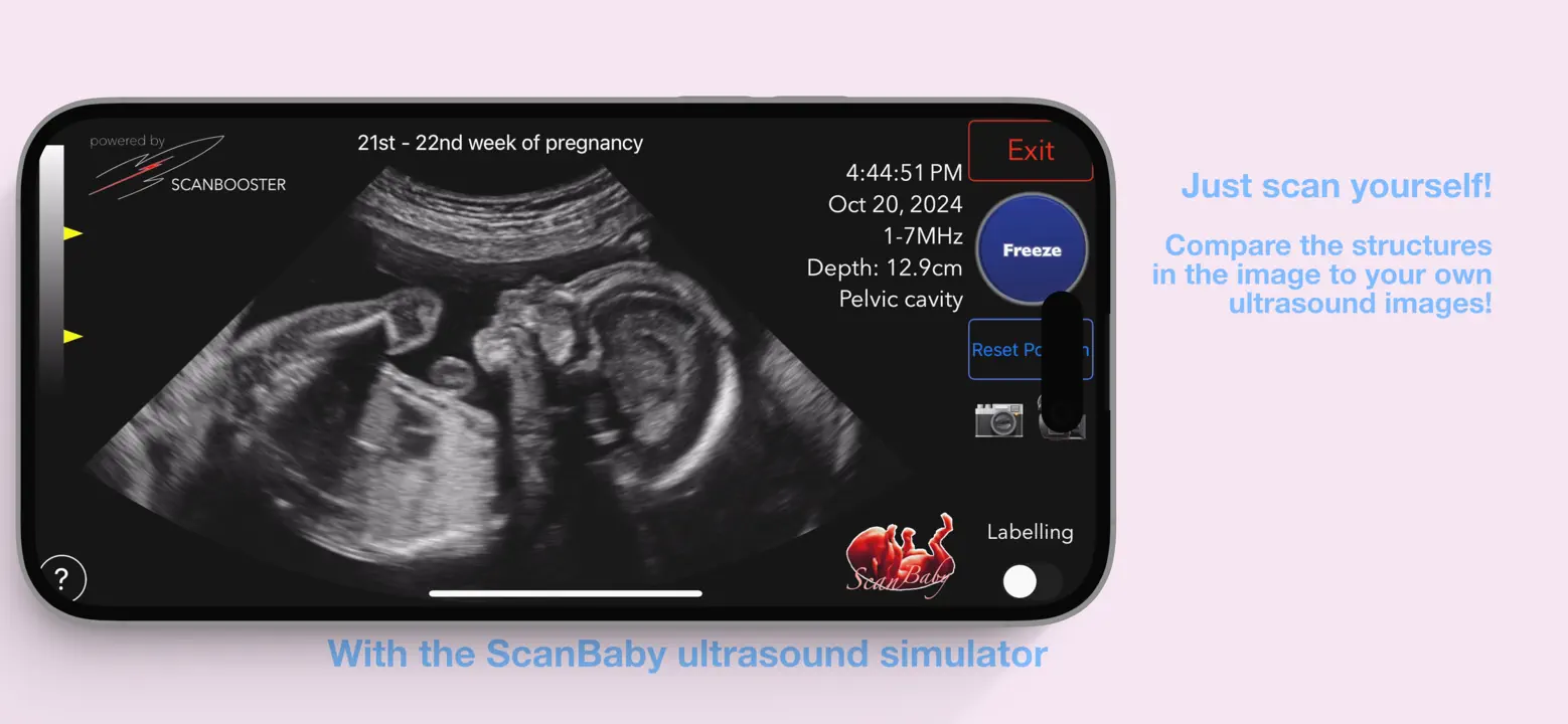ScanBaby learn baby ultrasoundのスクリーンショット（3/8）