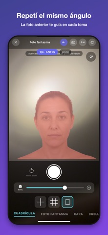 Antes y Después: Fotos Médicas screenshot