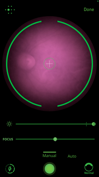 Remidio FOP iPhone screenshot 6 - Medical app