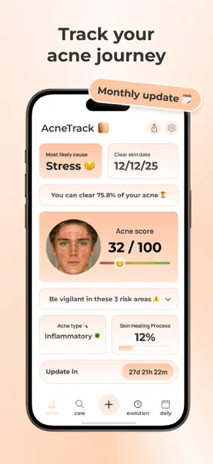 AcneTrack – Your Acne Journey screenshot 3