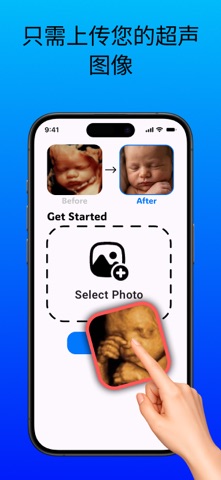 超声图像转照片: BabyGuess screenshot