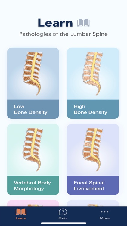 CTisus L-Spine Pathology screenshot-0