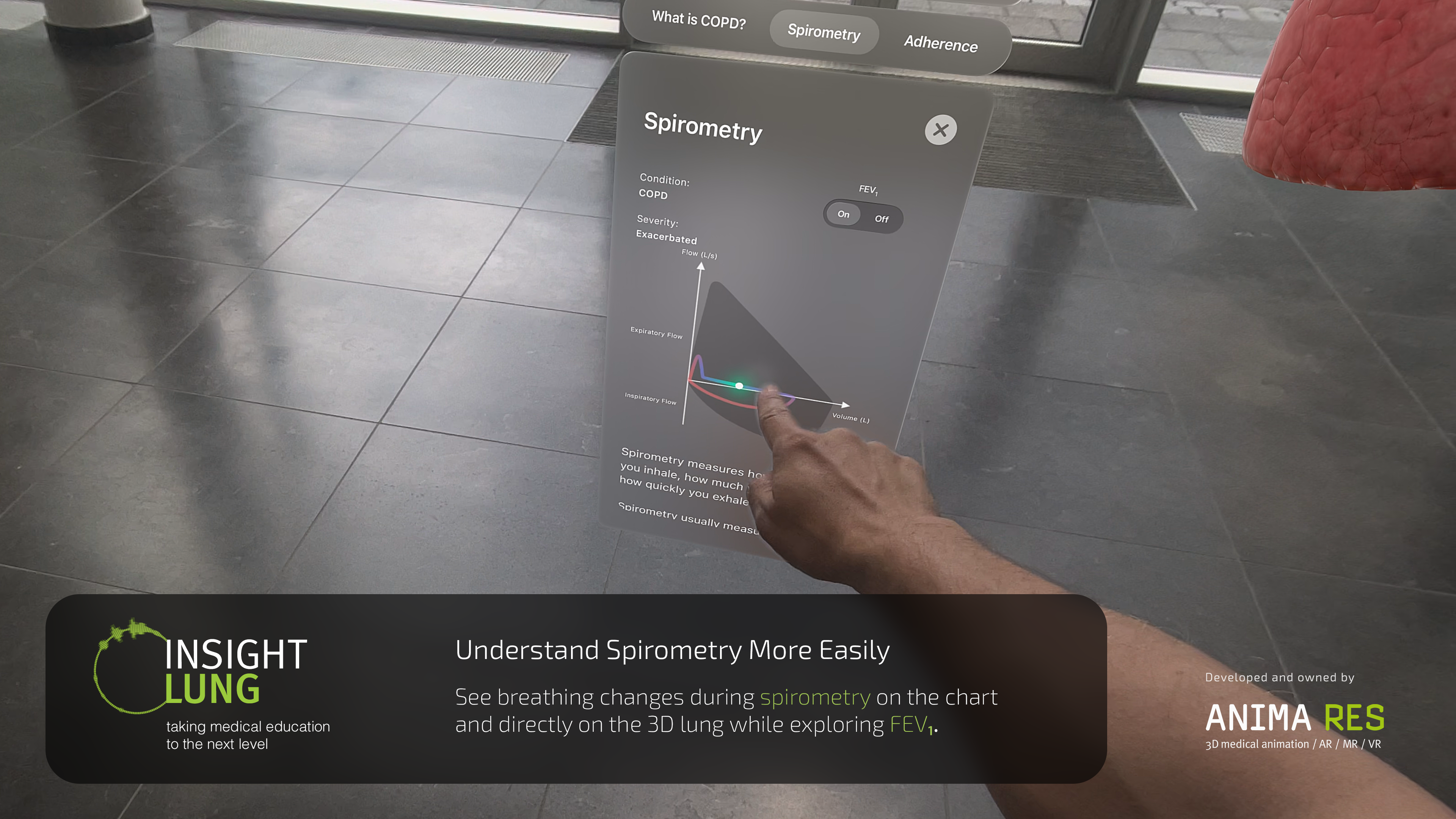 INSIGHT LUNG screenshot 18