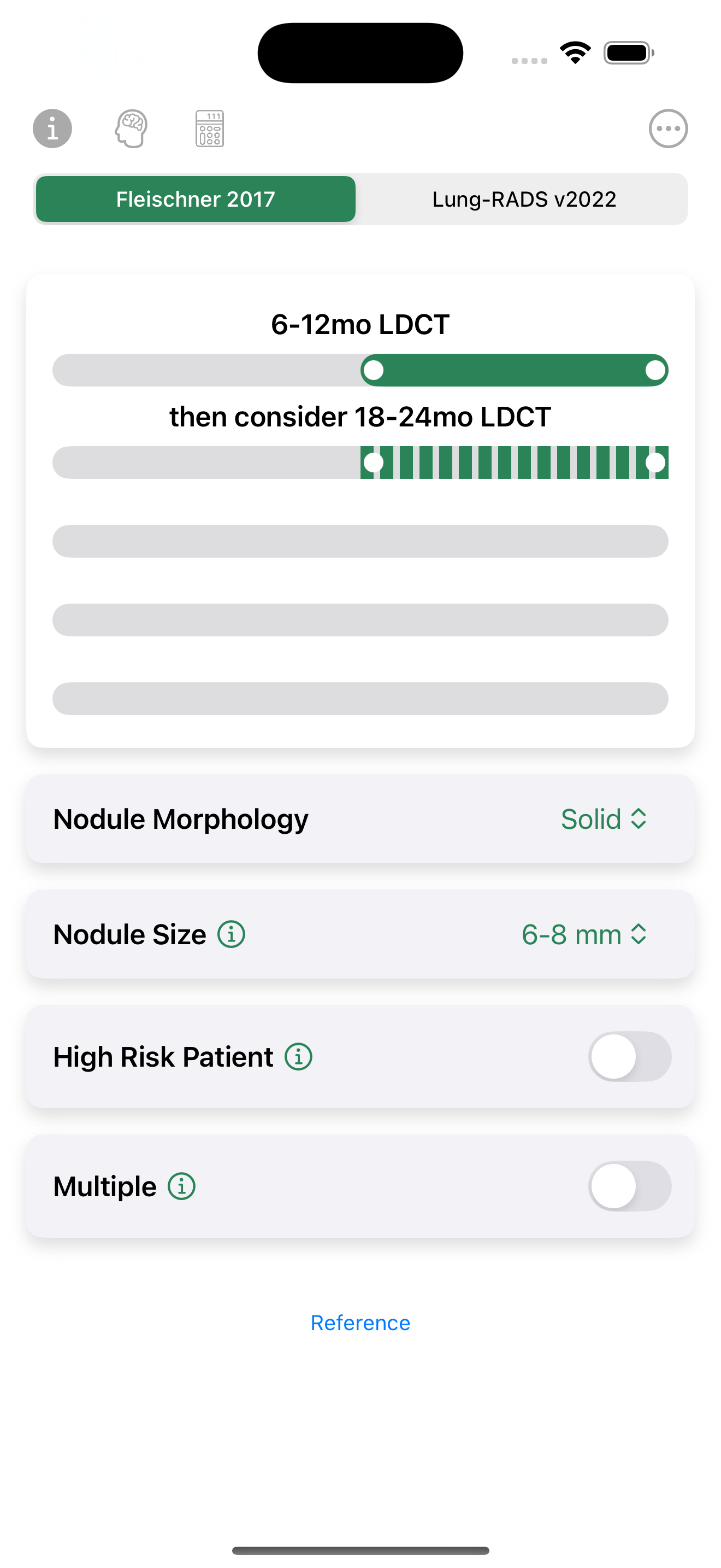 Lung Nodule Follow-up Guide