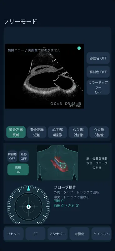 心エコートレーニング screenshot 5 of 6