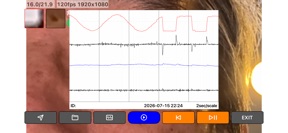 Eye Tracking Test screenshot
