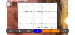 Eye Tracking Test iPhone screenshot
