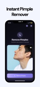 Clear Skin: Pimple Remover screenshot
