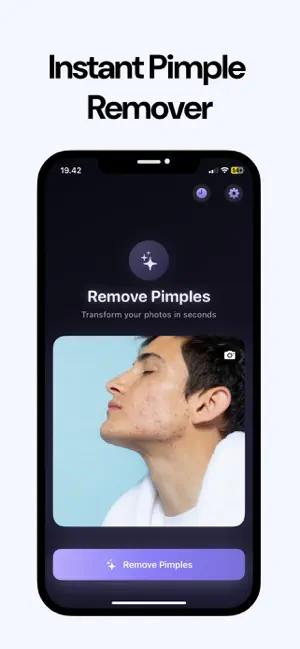 Clear Skin: Pimple Remover screenshot 2