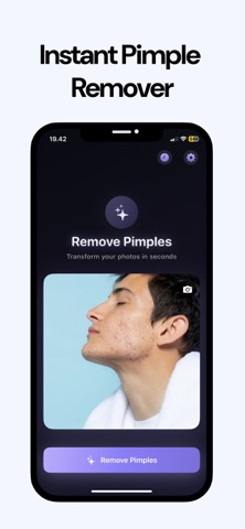 Clear Skin: Pimple Remover screenshot