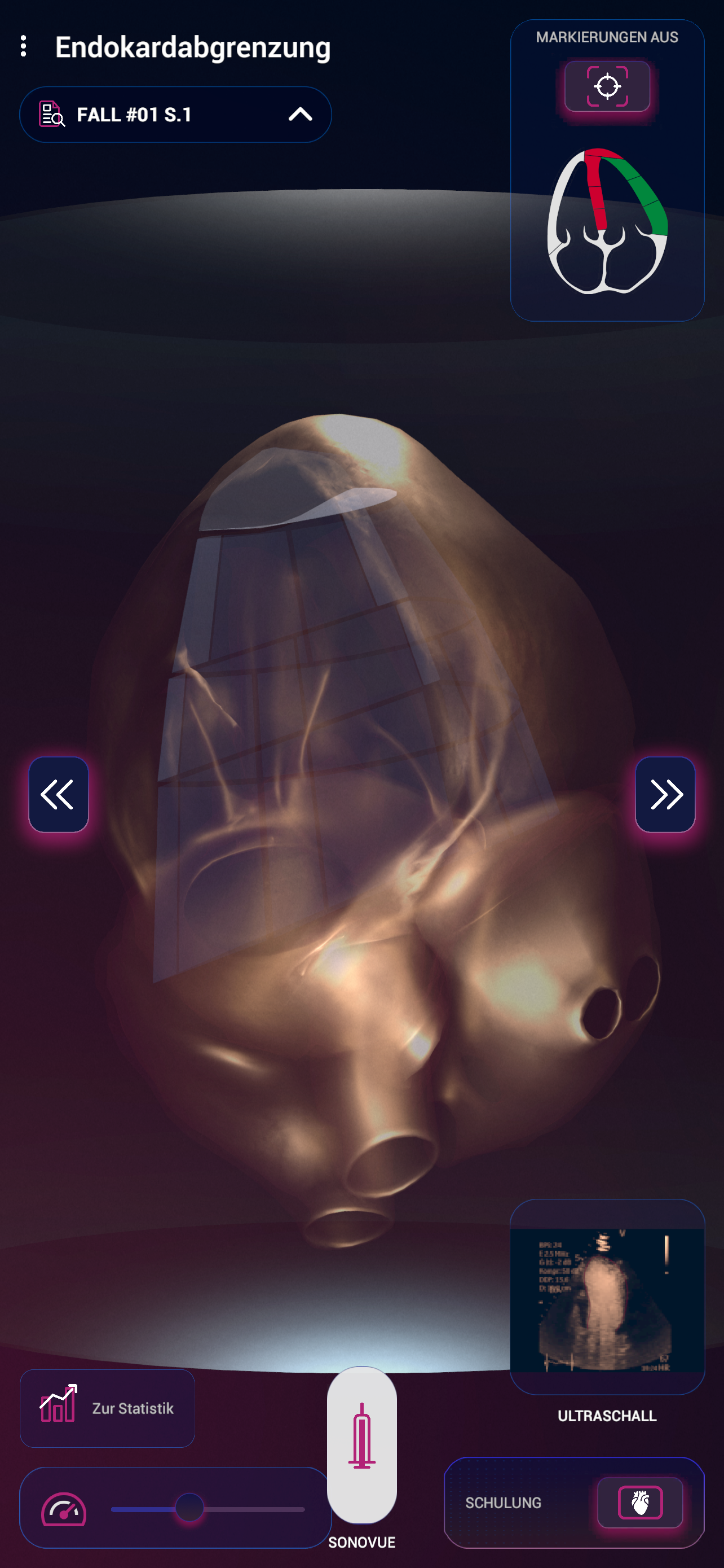 SonoVue screenshot 8