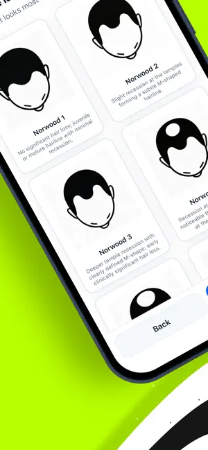 Hair Transplant AI Calculator screenshot 4