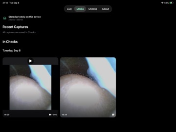 OtoSee: WiFi Otoscope Camera iPad screenshot