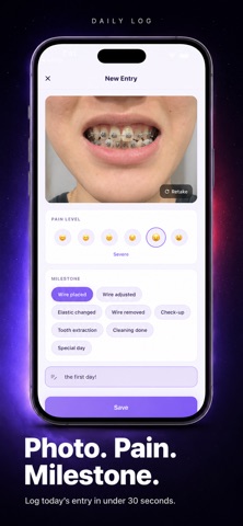 Bracer: Orthodontic Tracker Screenshot 4 of 7