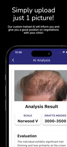Hair Transplant AI Cost Expert screenshot