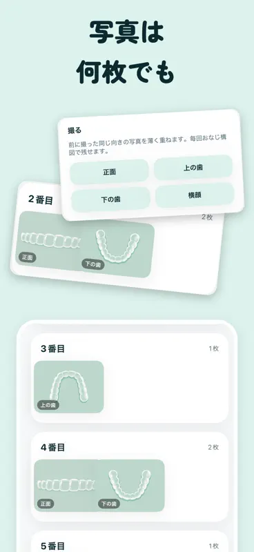 かんたん矯正記録 - マウスピース矯正の装着時間タイマー screenshot 3 of 5