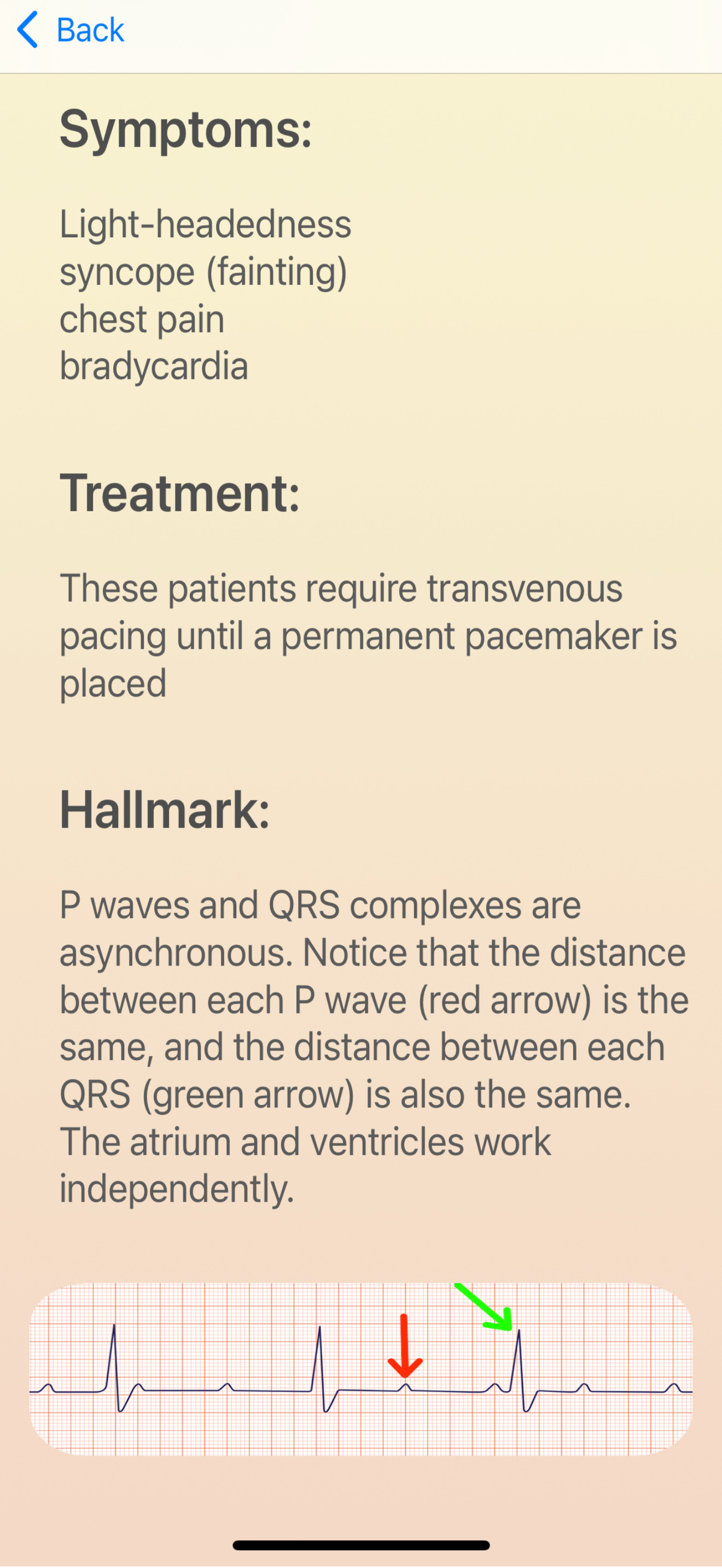 ECG Guide Ultimate