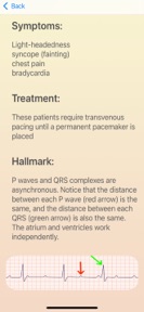 ECG Guide Ultimate screenshot