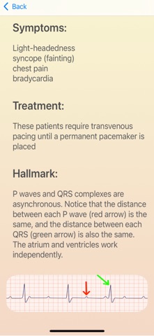 ECG Guide Ultimate screenshot