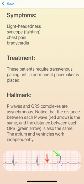 ECG Guide Ultimate Screenshot 3 of 7