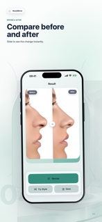 NoseMirror: AI Preview screenshot 4