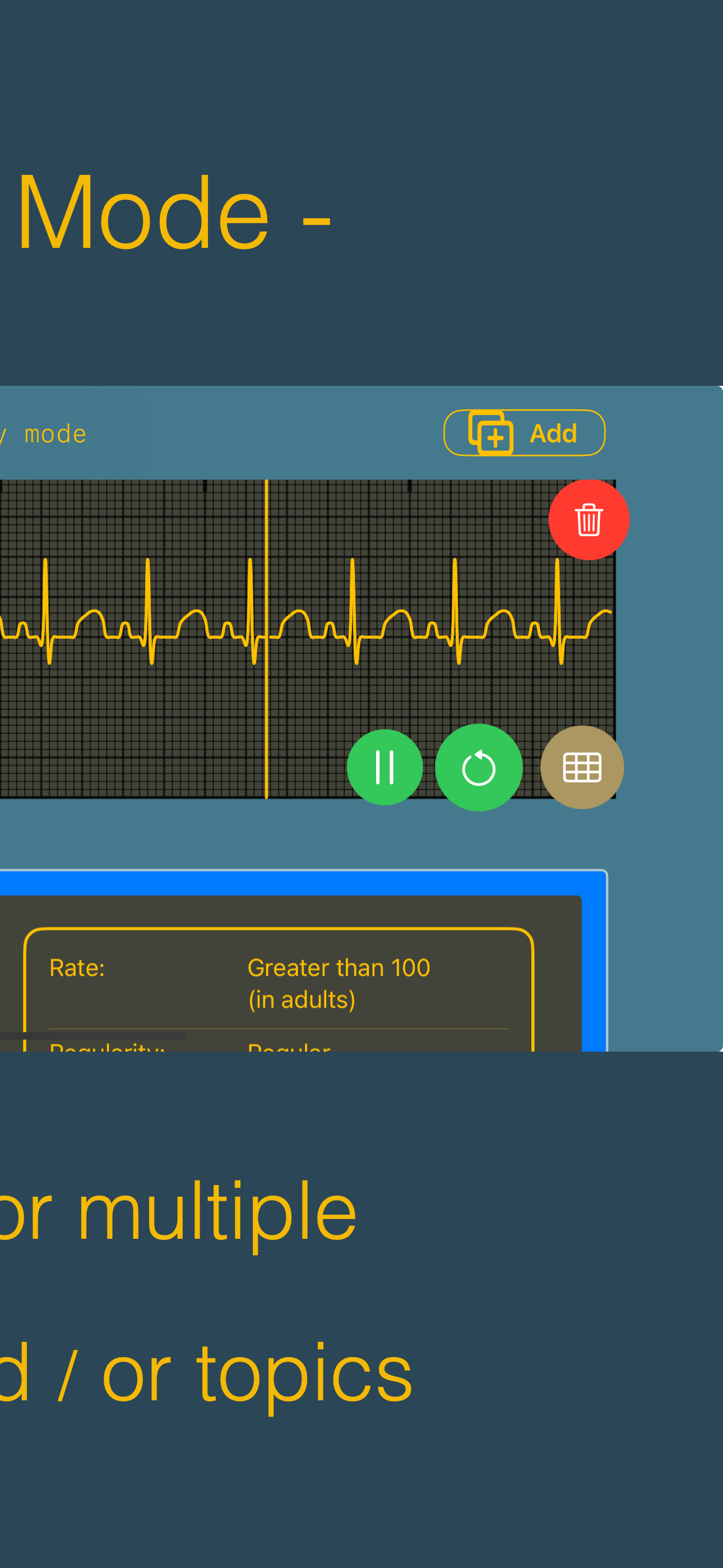 arrhythmia
