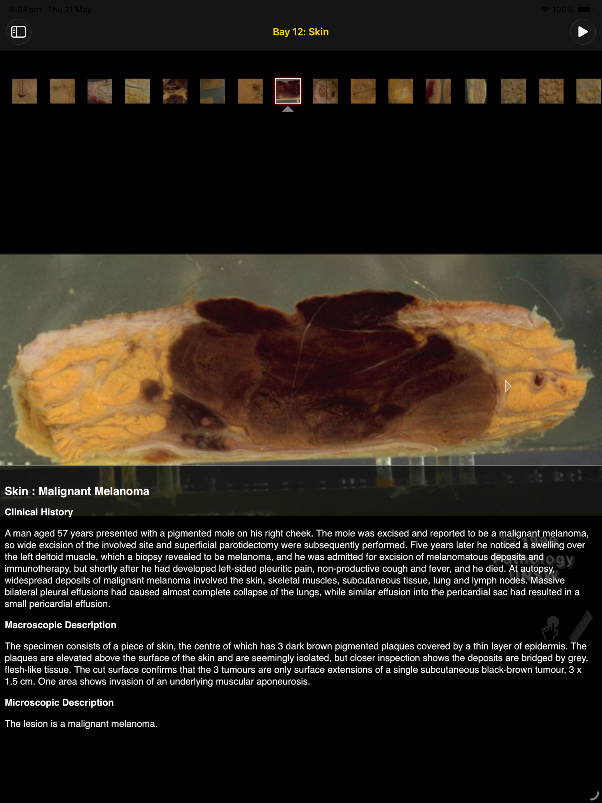 Images Of Disease