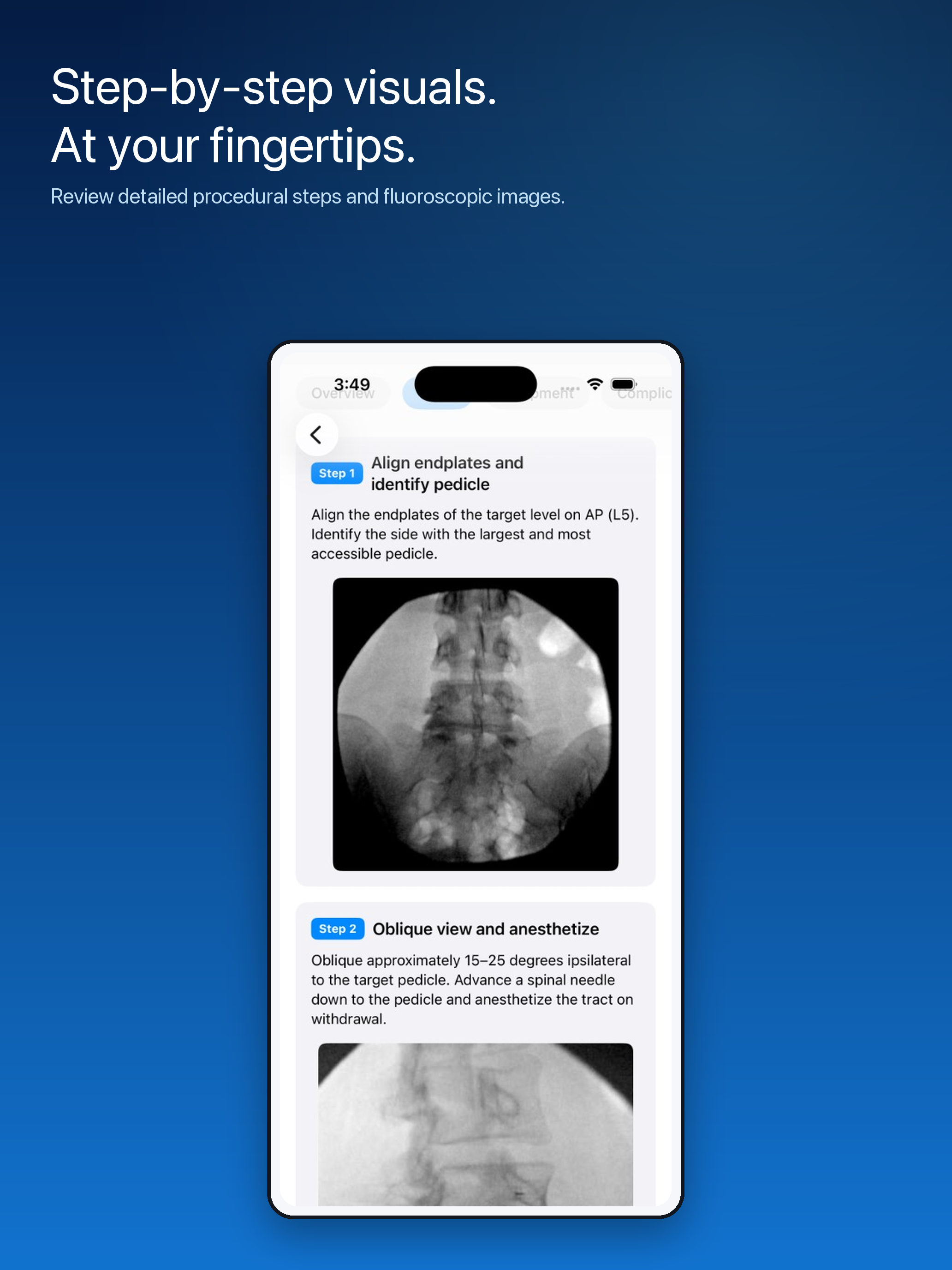 Advanced Pain Procedure Guide screenshot 5