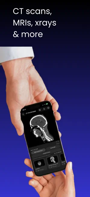 DICOM Viewer : MRI CT XRAY & + iPhone screenshot 4