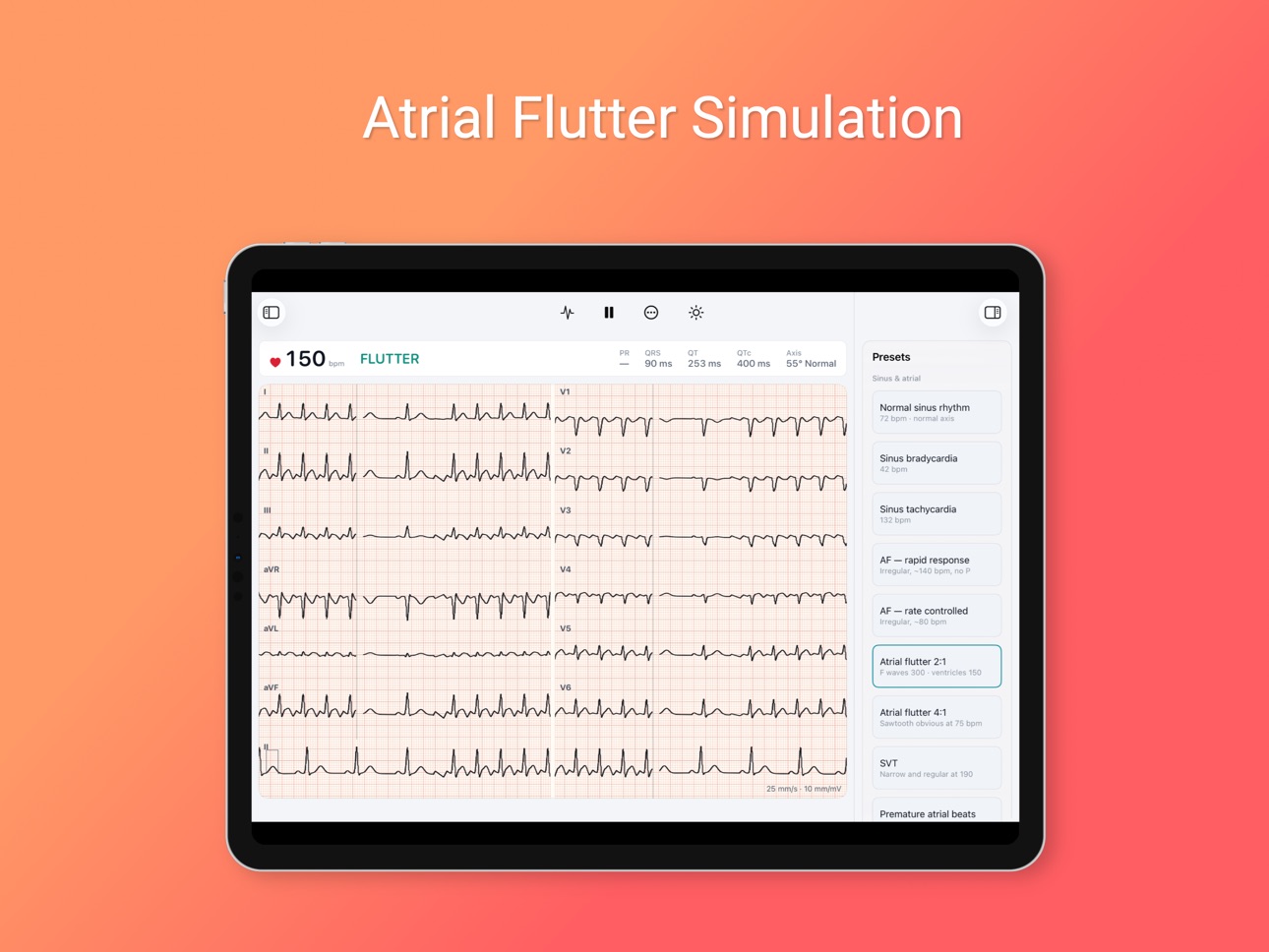 Screenshot 6 of Einthoven Lab