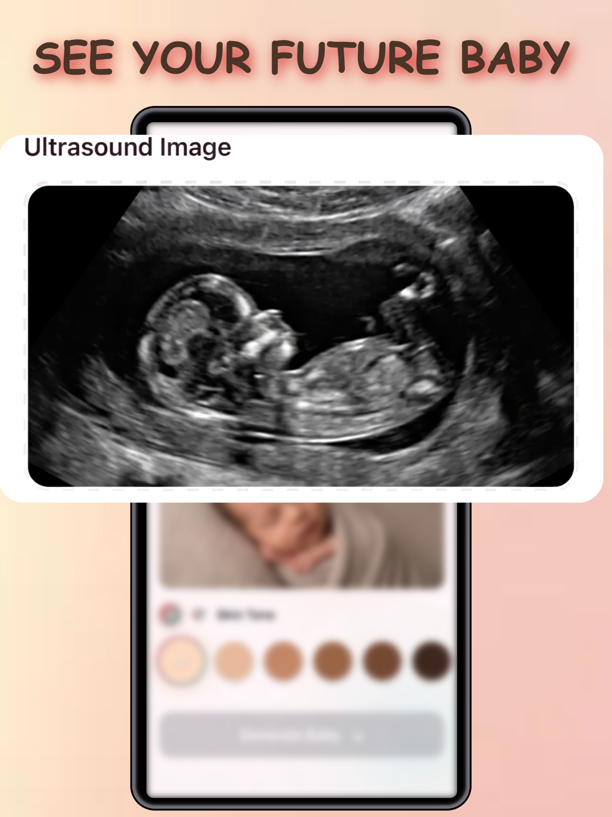 Ultrasound to Image: BabyPic
